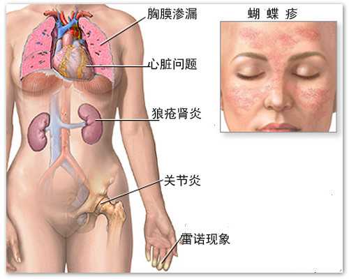 缓解哺乳期喉咙痛妙方与护理要点