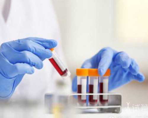 北京朝阳医院辅助生殖技术费用与专家介绍