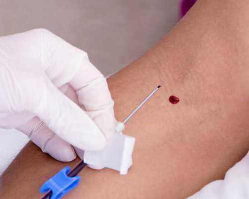 解析北京三院试管龙凤胎可能性与助孕费用